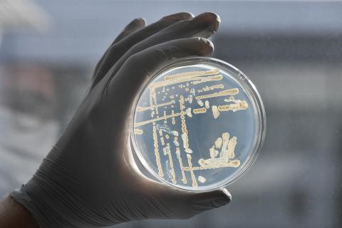 Culture microbiologique en laboratoire